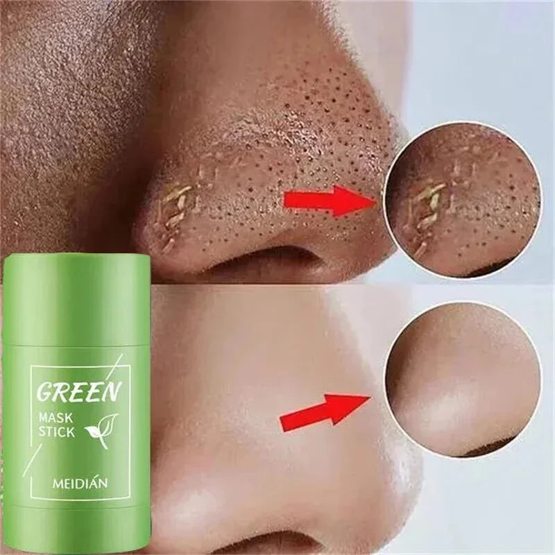 Máscara Facial De Limpeza Profunda, Removedor De Cravos, Tratamento Facial, Acne Blemish, Encolher Poros, Cosméticos De Beleza Coreanos, Cuidados Com A Pele