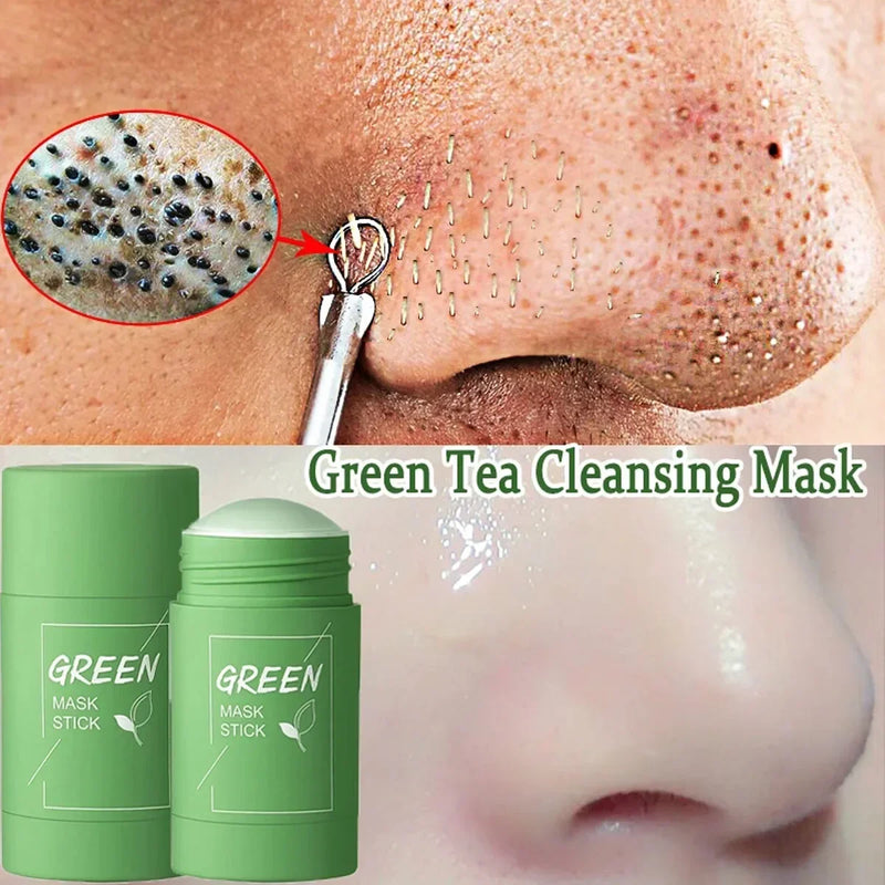 Máscara Facial De Limpeza Profunda, Removedor De Cravos, Tratamento Facial, Acne Blemish, Encolher Poros, Cosméticos De Beleza Coreanos, Cuidados Com A Pele