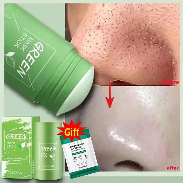 Máscara Facial De Limpeza Profunda, Removedor De Cravos, Tratamento Facial, Acne Blemish, Encolher Poros, Cosméticos De Beleza Coreanos, Cuidados Com A Pele