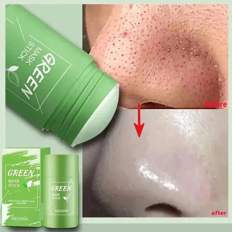 Máscara Facial De Limpeza Profunda, Removedor De Cravos, Tratamento Facial, Acne Blemish, Encolher Poros, Cosméticos De Beleza Coreanos, Cuidados Com A Pele